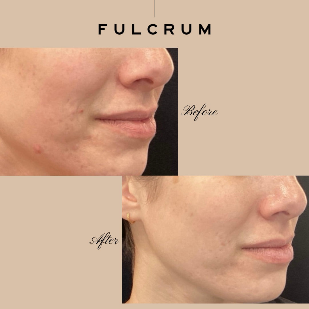 BBL+MOXI (1927 Photofacial)