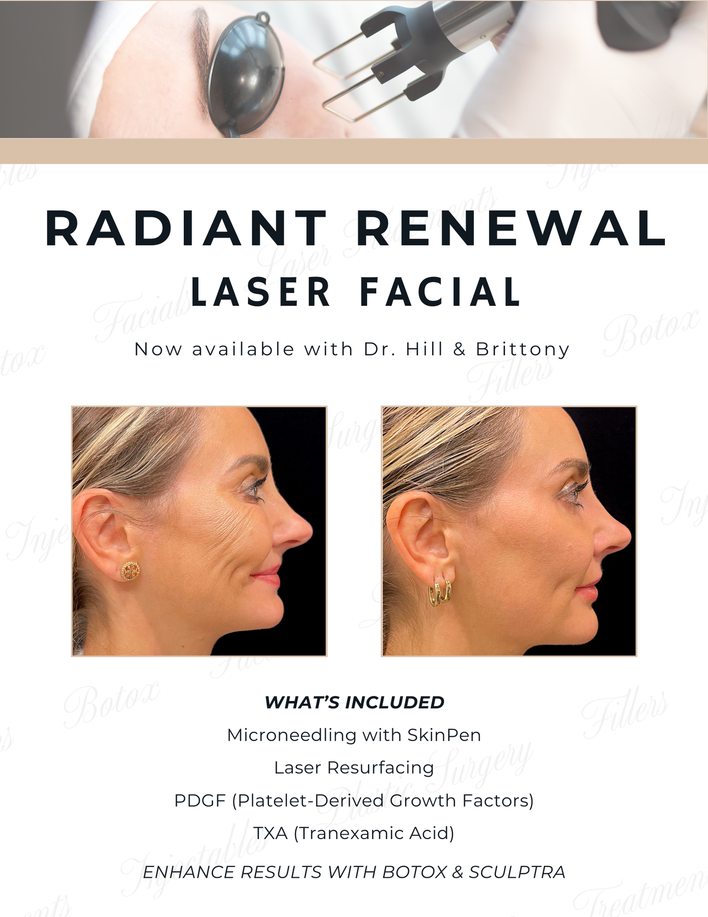 Radiant Renewal | Laser Facial