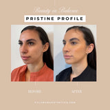 Pristine Profile