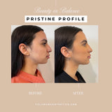 Pristine Profile