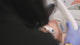 Photofacial (BBL/IPL)